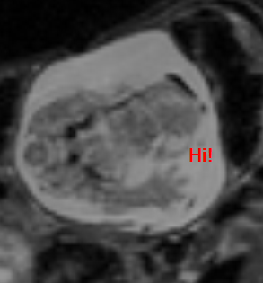 mri_embryo