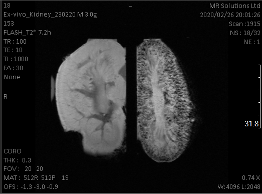 mri_kidneys